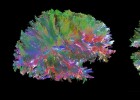 Un ‘Google Maps’ para conocer el cerebro Un ‘Google Maps’ para conocer el cerebro
