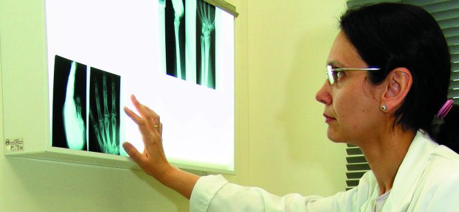 Una doctora de la mutua Asepeyo mirando la radiografía de un trabajador.