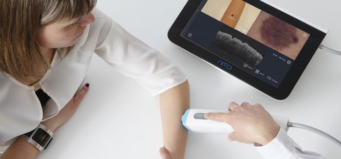 Biopsia virtual con tecnología española