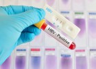 La hepatitis C dispara la factura en los hospitales La hepatitis C dispara la factura en los hospitales