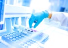 La inmunoterapia sigue abriéndose paso en oncología La inmunoterapia sigue abriéndose paso en oncología