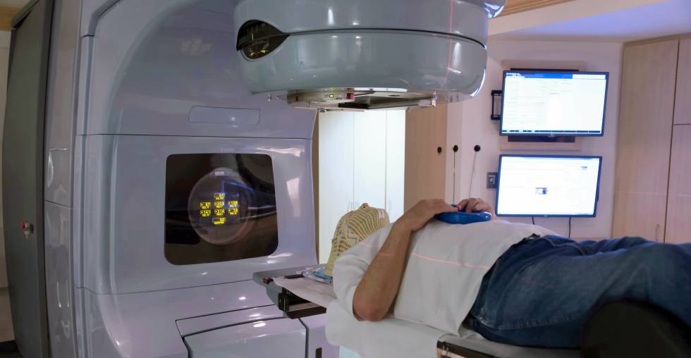 radioterapia oncológica