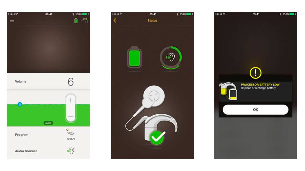 Implante coclear iPhone