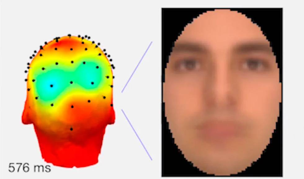 Rostro escáner cerebral