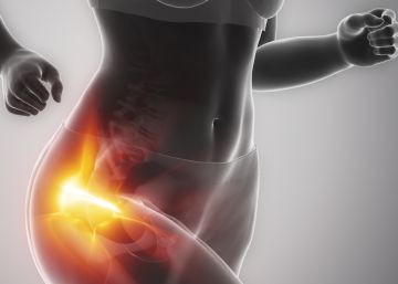 La osteoporosis, una dolencia silenciosa con rostro de mujer