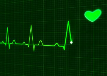 El electrocardiograma de los Apple Watch también llegará a relojes Wear OS