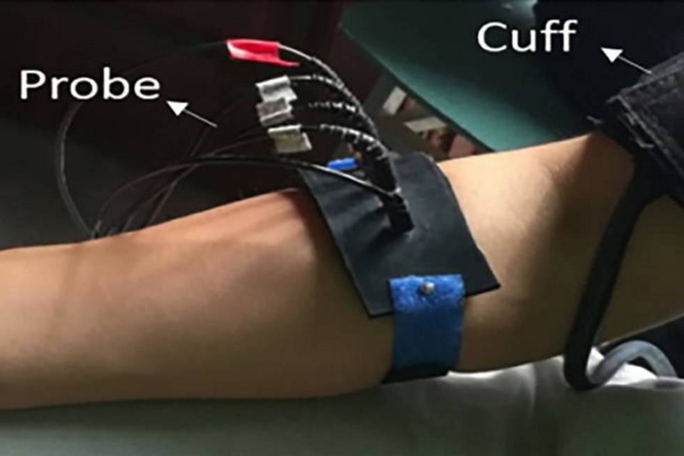 Este wearable ayudará a diagnosticar problemas cardíacos de forma más efectiva