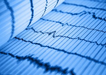 Este wearable ayudará a diagnosticar problemas cardíacos de forma más efectiva