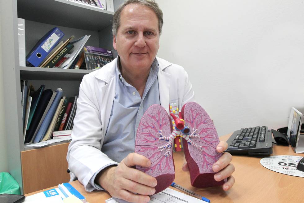Javier de Castro: “Es muy preocupante la mayor mortalidad por cáncer de pulmón en mujeres”