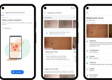 La apuesta de Google para evitarnos sustos médicos si buscamos en Google La apuesta de Google para evitarnos sustos médicos si buscamos en Google